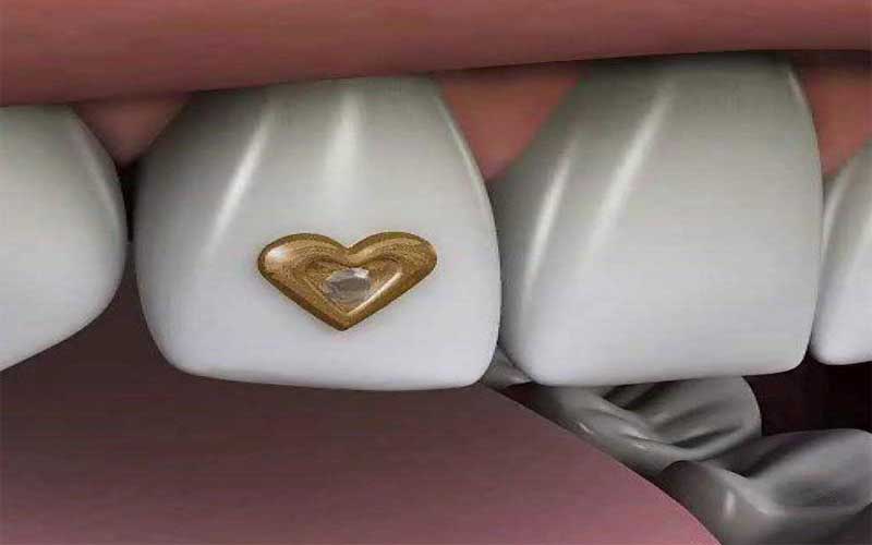 دندانپزشکی زیبایی 